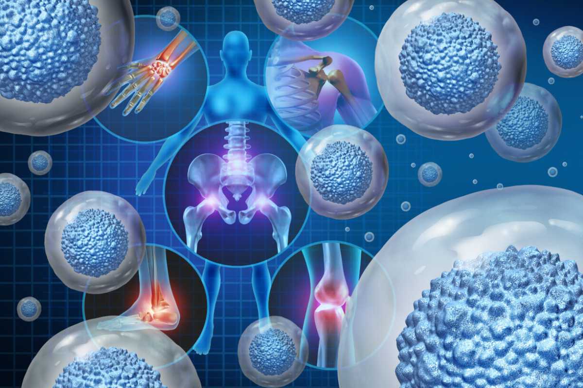 Man holding his knee in pain