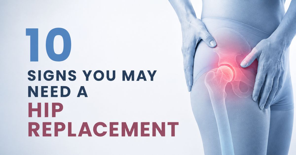 10 Signs You May Need a Hip Replacement